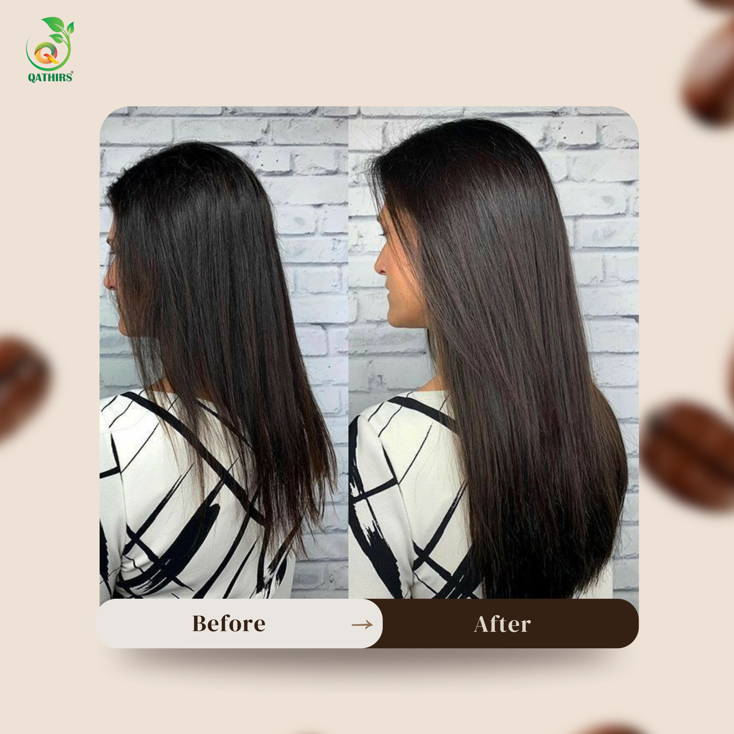 Qathirs Hair Growth Scalp Spray | Oil-Type Natural DHT Blocker | Stops Hair Fall &  Boosts Growth – 40ml
